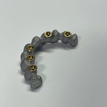 Implantátumos váz - anodizált interface-el Implantátumos váz - anodizált interface-el - PREMET Kft. - Pásztor Zsolt