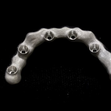 Implantátumos váz - mart persellyel Implantátumos váz - mart persellyel - PREMET Kft. - lézerszinterezés - Pásztor Zsolt