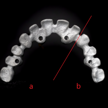 Implantátumos váz - a) nem kezelt b) sav kezelt Implantátumos váz - a) nem kezelt b) sav kezelt - PREMET Kft. - lézerszinterezés - Pásztor Zsolt